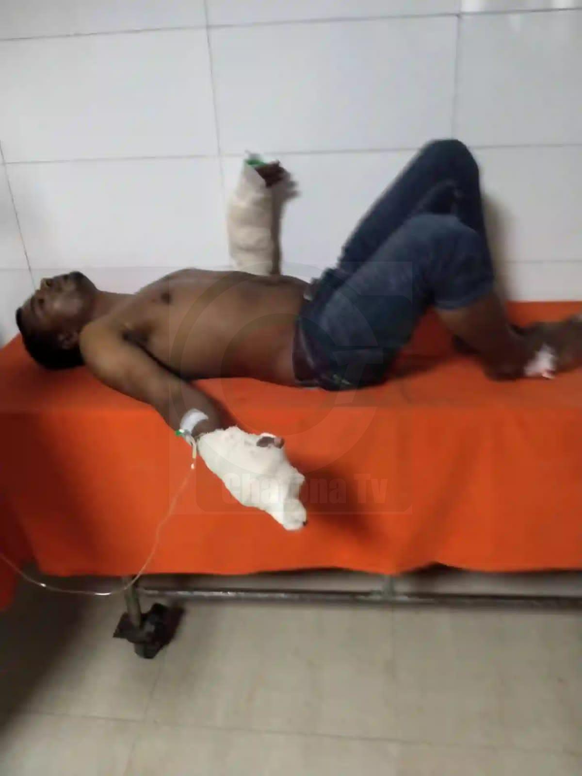 নরসিংদীতে সিগারেট খাওয়ার ম্যাচ চাওয়াকে কেন্দ্র করে কথা কাটাকাটির জেরে যুবকের কব্জি কেটে দিয়েছে সন্ত্রাসীরা